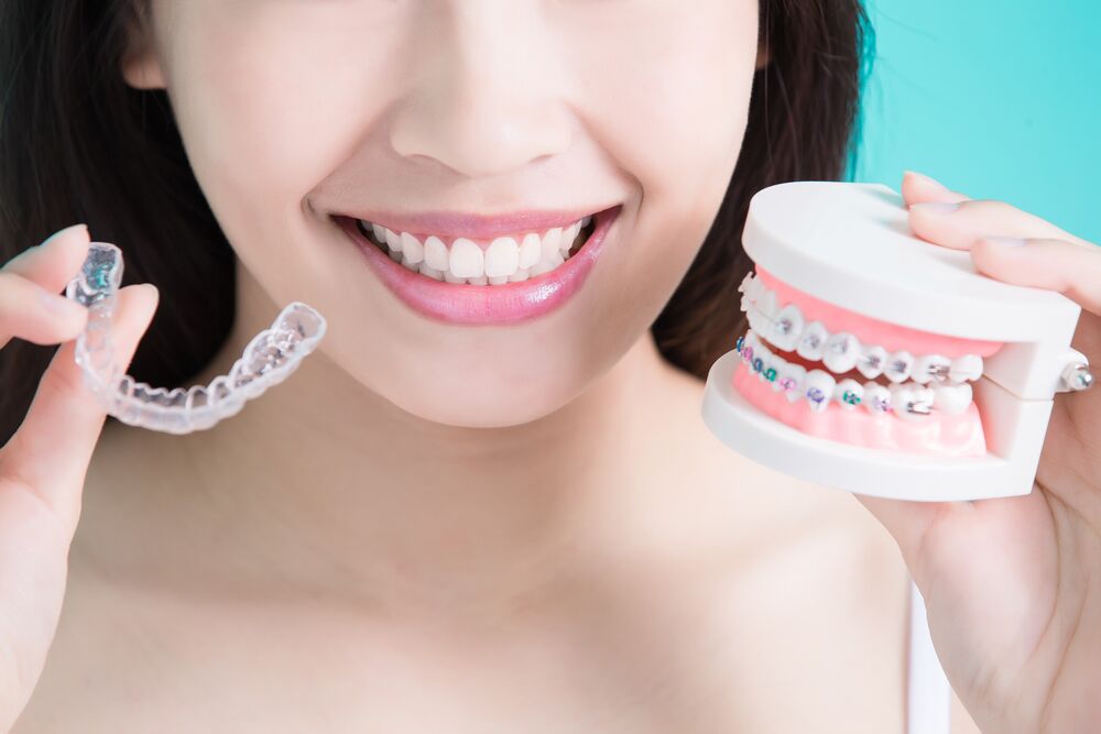 Guide to Braces  Metal, Ceramic, and Lingual Braces